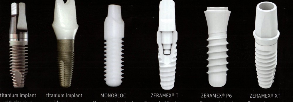 Evolution in Implant Dentistry